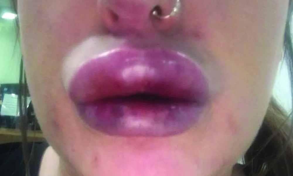 skin lips prob.jpg